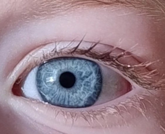Close-up of a two-year-old child's eye showing a distinctive serpent-like iris pattern, inspired by the legendary Sigurd Snake-in-the-Eye and Viking heritage.